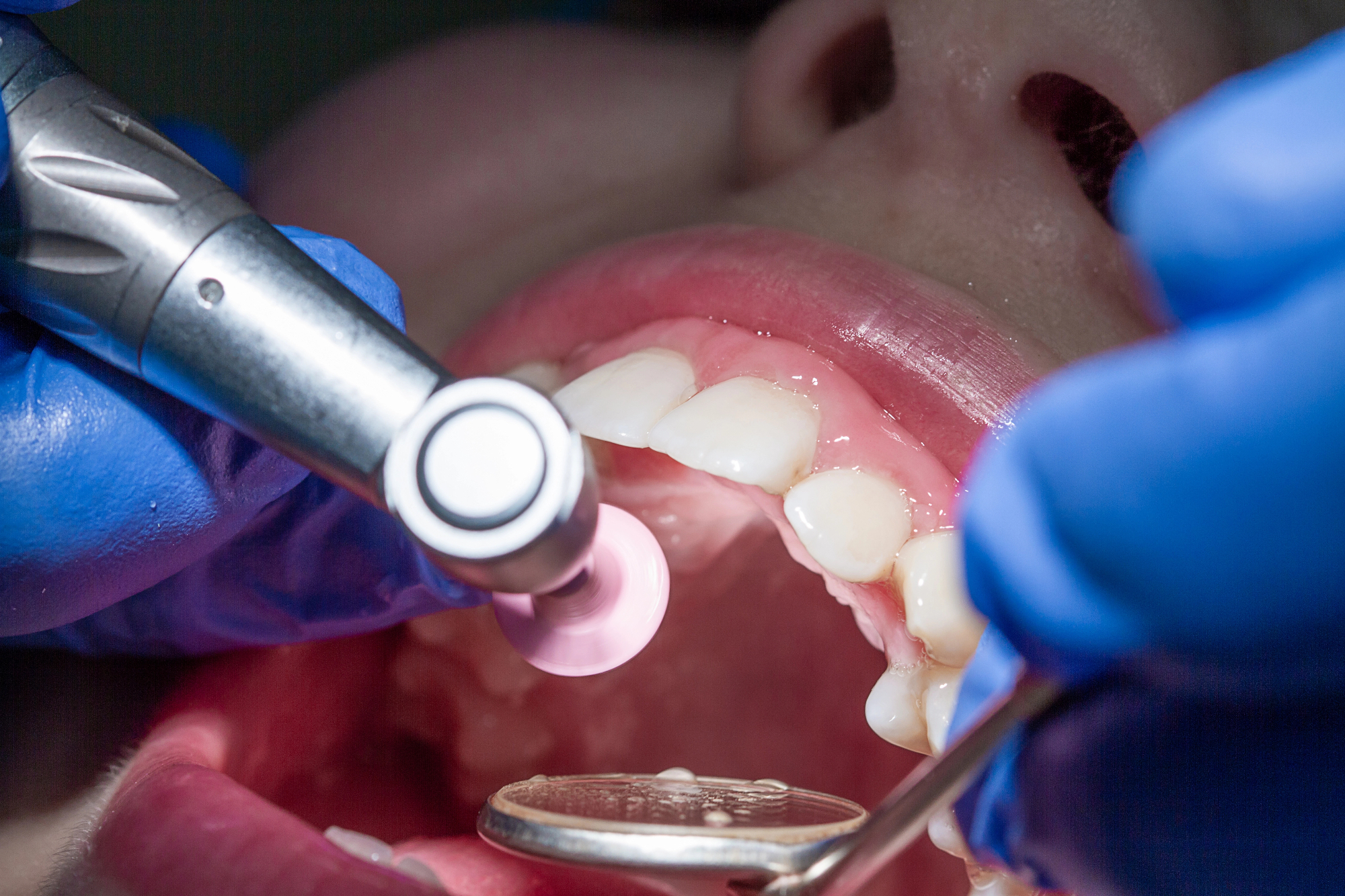 Paradontologija Nova Gorica me je pošteno rešila